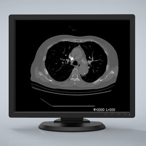 医用显示器 - R193G - Nanjing Jusha Display Technology - 1280 x 1024 / 液晶 / LED