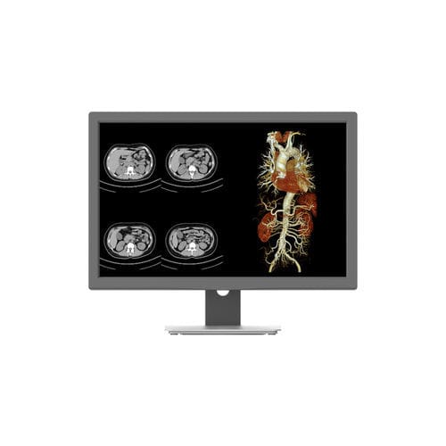 诊断显示器 - CR240G - Nanjing Jusha Display Technology - 高解析度 / 1920x1200 / 24"