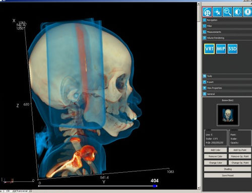 医学成像软件模块 - iQ-3D - IMAGE Information Systems - 3D 可视化 / 后处理 / 平板电脑