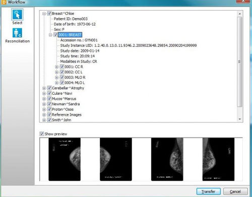 医用软件 - DICOMReader - IMAGE Information Systems - DICOM文件 / 可视化 / 医学影像导入