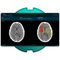 中风诊断软件e-StrokeBrainomix