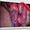 医用监视器EndoVue PlusNDS Surgical Imaging