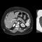 医用软件PIQECanon Medical Systems Europe