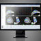 治疗计划制定软件BrachyVision™Varian Oncology