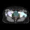 医用人工智能平台Varian Oncology