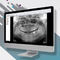 医疗可视化软件OMSCarestream Dental
