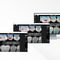 牙科软件Pearl's Second Opinion&reg;Carestream Dental