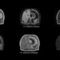 医用软件4D MR-RTPhilips Healthcare