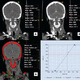 医用软件模块 / 用于颅内成像 / 诊断 / 带跟踪系统