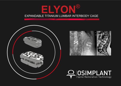 ELYON EXPANDABLE TITANIUM LUMBAR INTERBODY CAGE