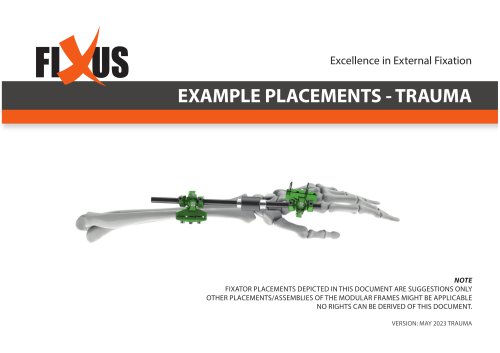 FIXUS - EXAMPLE PLACEMENTS - TRAUMA