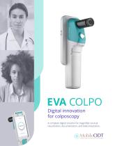 EVA System for Colposcopy