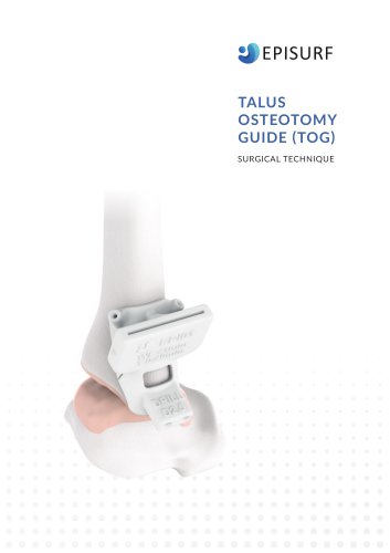 TALUS OSTEOTOMY