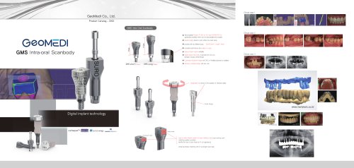GMS Intra-oral Scanbody