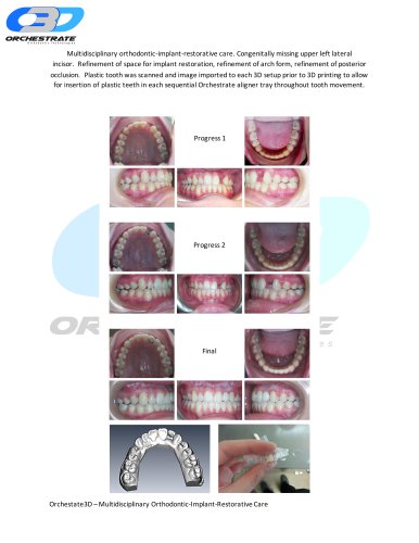 Multidisciplinary Orthodontic Implant Restorative care