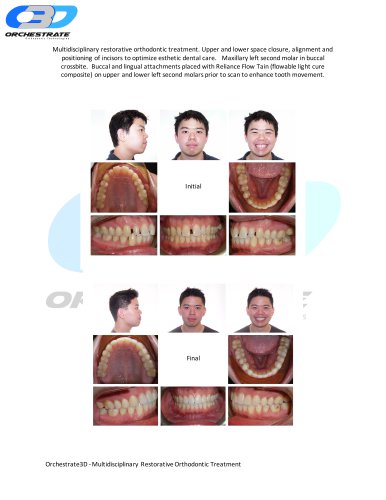 Multidisciplinary Restorative Orthodontic Treatment