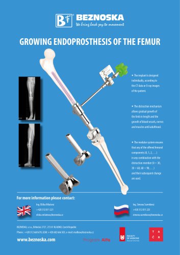 GROWING ENDOPROSTHESIS OF THE FEMUR