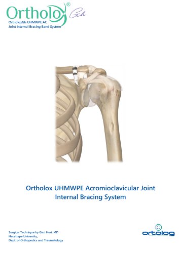 Ortholox UHMWPE ACJ Surgical Technique