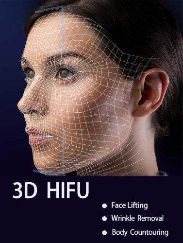3D HIFU
