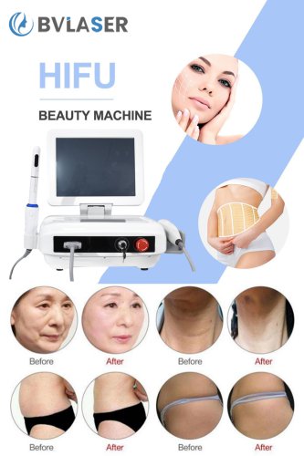 China HIFU ultrasound machine supplier-BVLASER. The best HIFU machine professional. OEM HIFU anti-wrinkle machine.