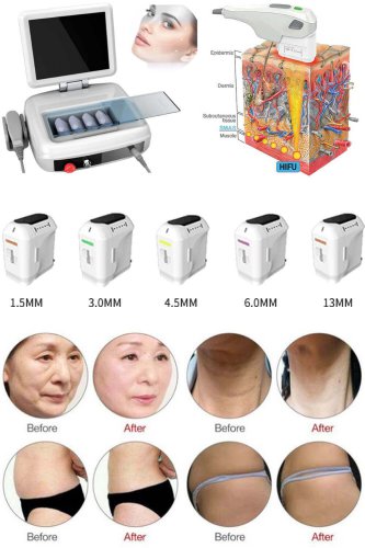 HIFU Skin Tightening Machine