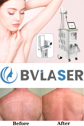 medical grade laser hair removal machine diode laser hair removal machine professional