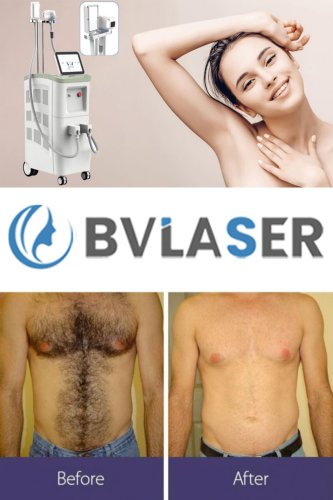 permanent laser hair removal best laser hair removal machine professional