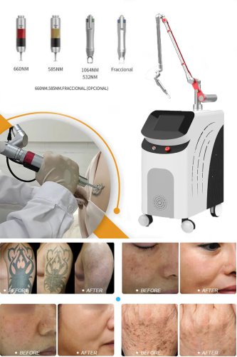 picosecond aesthetic laser picosecond laser tattoo removal machine for sale