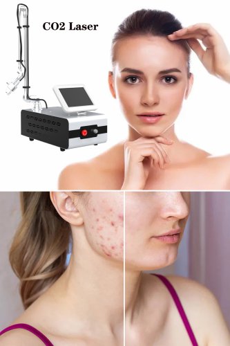 portable CO2 fractional laser machine full face CO2 laser resurfacing dermatology