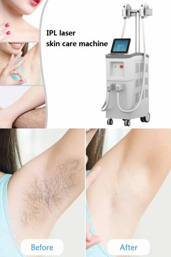 Professional IPL laser machine manufacturer-BVLASER. The best IPL laser machine brand. IPL laser skin care machine.