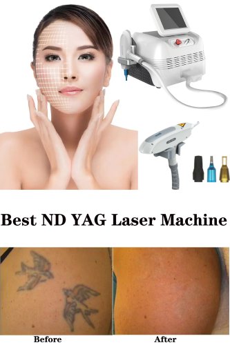 Q switched ND YAG laser tattoo removal machine 1064 nm long pulsed ND YAG laser