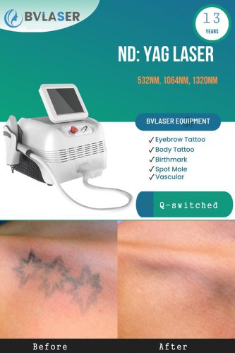 The best ND YAG laser machine manufactuer&supplier-BVLASER. OEM ND:YAG picosecond laser. Q-switched ND YAG laser tattoo removal machine.