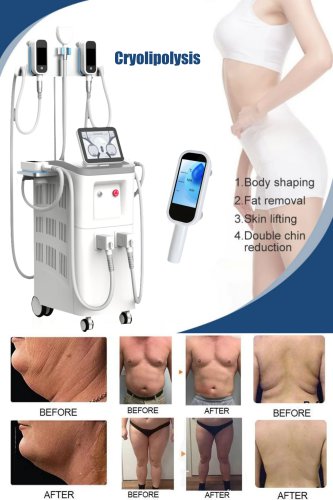 The best professional cryolipolysis machine. Cryolipolysis fat freeze slimming machine. China cryolipolysis machine manufacturer-BVLASER