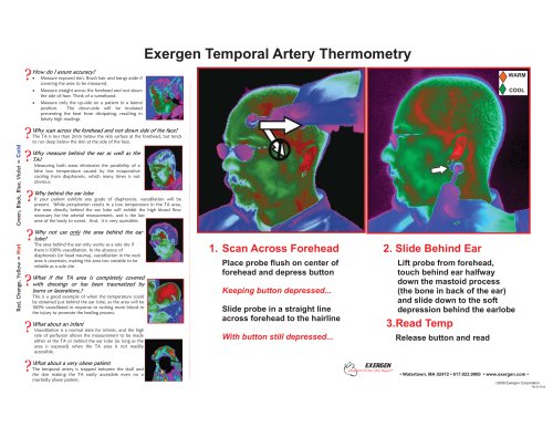 Exergen Temporal Artery Thermometry