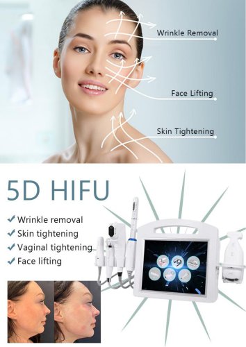 5 in 1 HIFU(microneedle+HIFU+vaginal HIFU+Liposonix)