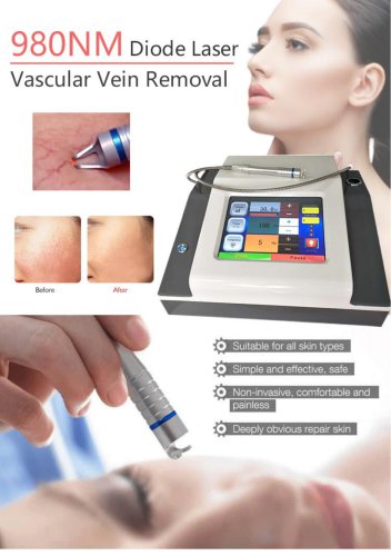 vascular removal laser-1