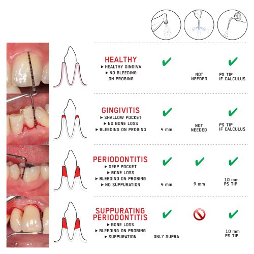 Natural_Teeth