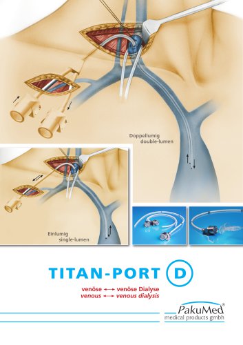 TITAN-PORT DIALYSIS