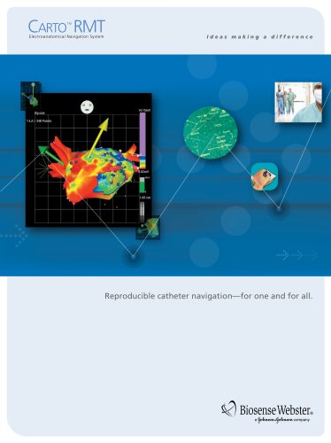 CARTO RMT Electroanatomical Navigation System Brochure