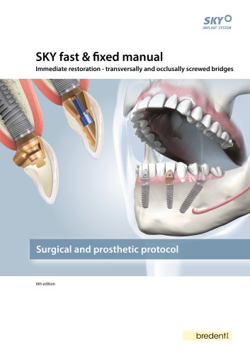 SKY fast & fixed &ndash; manual