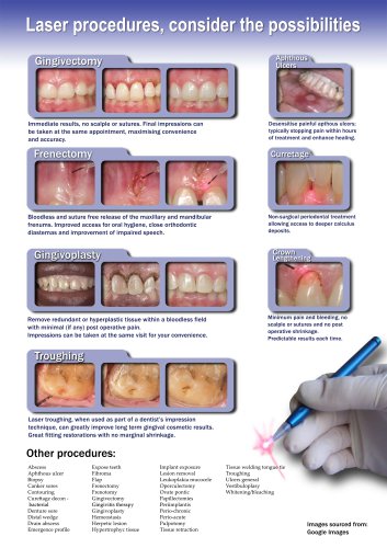 Laser procedures, consider the possibilities