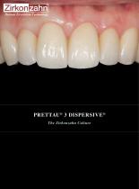 Insert Prettau® 3 Dispersive®_2025