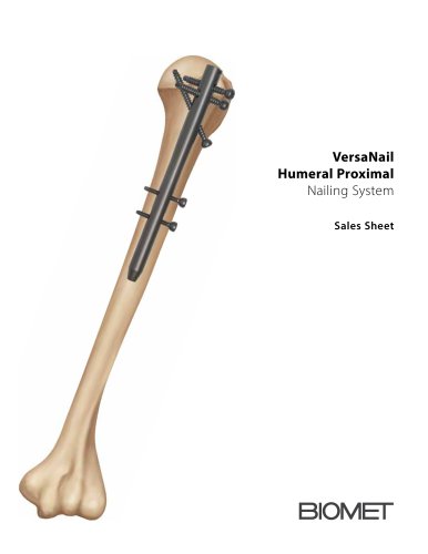 VersaNail Humeral Proximal Nailing System Sales Sheet