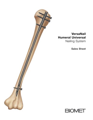 VersaNail Humeral Universal Nailing System Sales Sheet