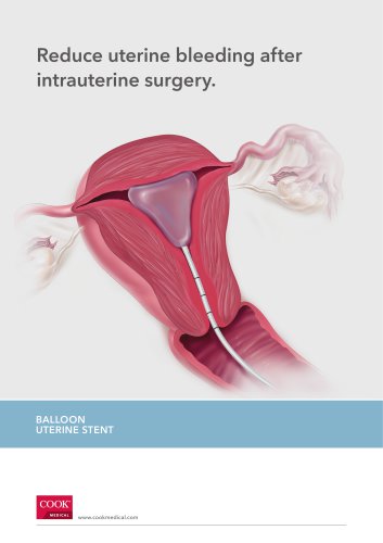 Reduce uterine bleeding after intrauterine surgery.