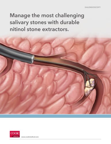 Salivary Stone Extractors