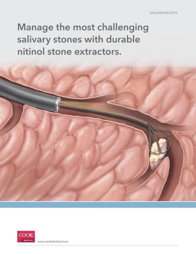 Salivary Stone Extractors Datasheet