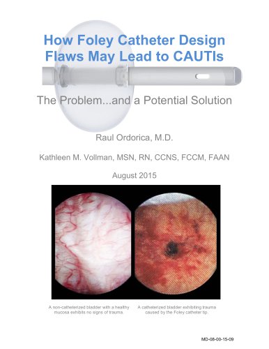 How Foley Catheter  Design  Flaws May Lead to  CAUTIs