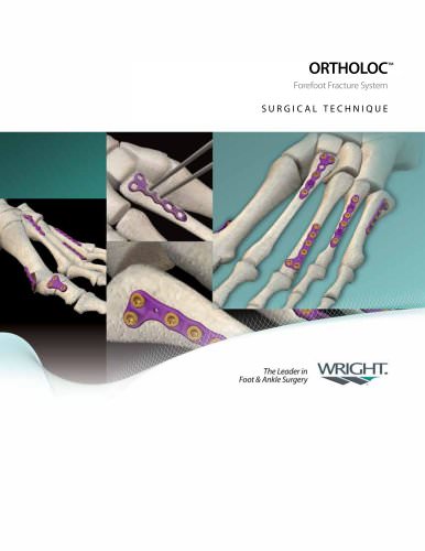 ORTHOLOC® Forefoot Fracture System ? FA255?409