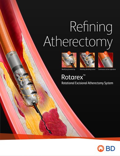 Refining Atherectomy  Rotarex™